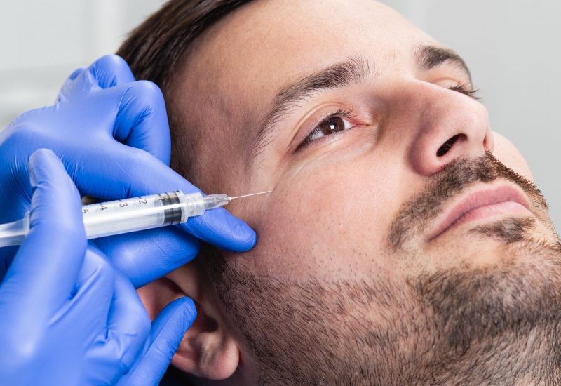 Sculptra Tampa