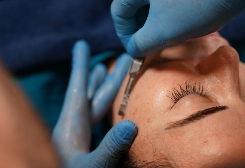Dermaplaning in Tampa