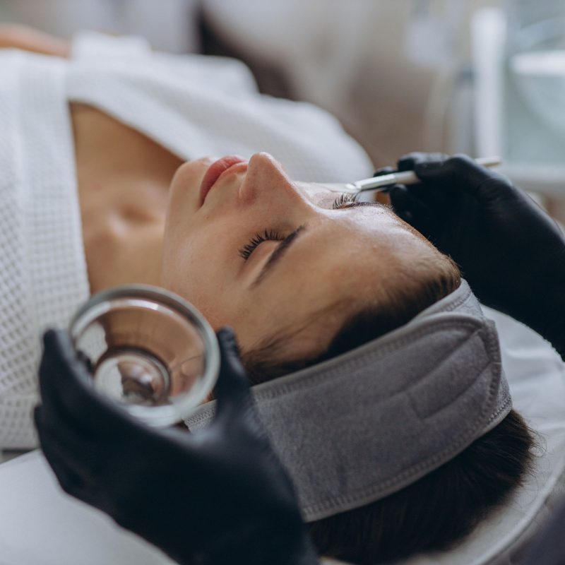 Chemical Peels Tampa