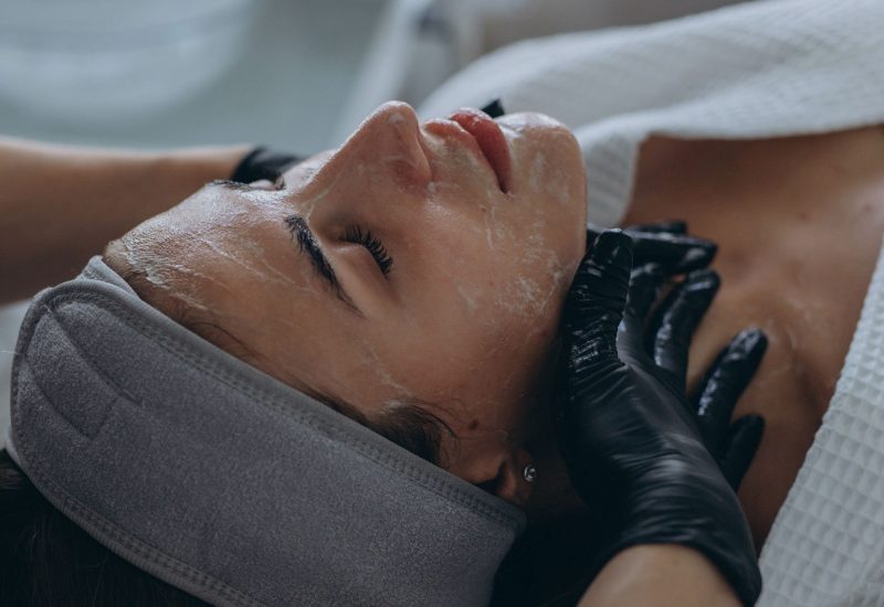 Chemical Peel Tampa